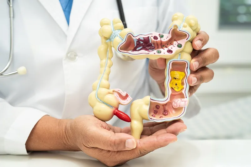 Consulta de Coloproctología